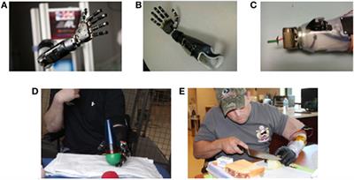 Frontiers | Initial Clinical Evaluation Of The Modular Prosthetic Limb